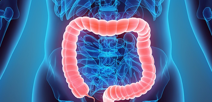 Tratament cancer de colon - CAZ